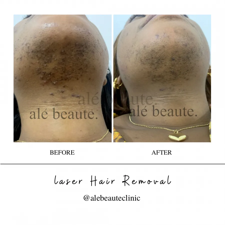 Ale Beaute Clinic