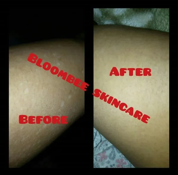 Bloombee skincare