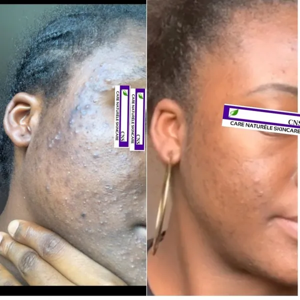 Care Naturéle Skincare