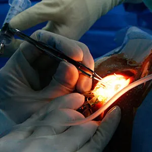 Choice Eye Clinic (Ikeja)