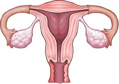 Cost of Fibroid Surgery in India