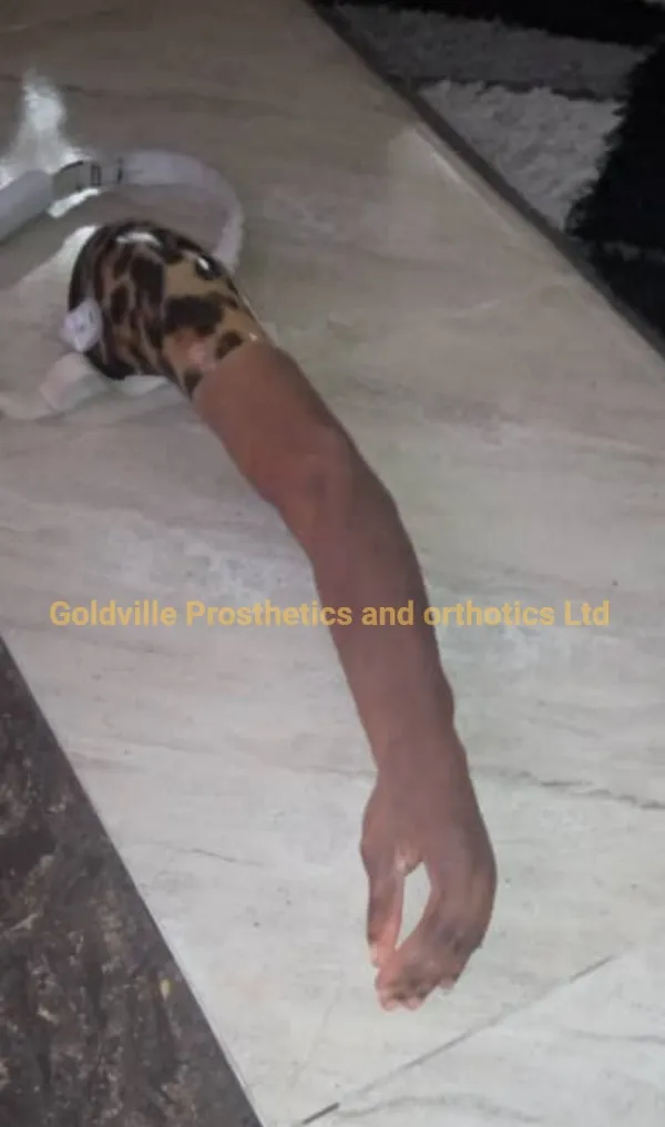 Goldville Prosthetics and Orthotics Ltd