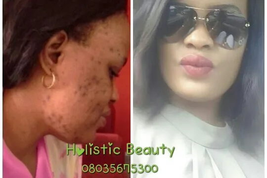Holistic Beauty