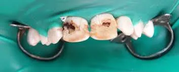 Ivory Dental Care Limited