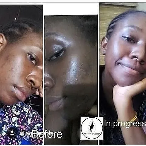 Moglow Skincare International