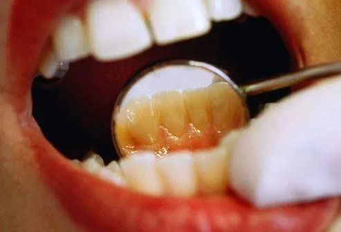 Palmview Dental Clinic