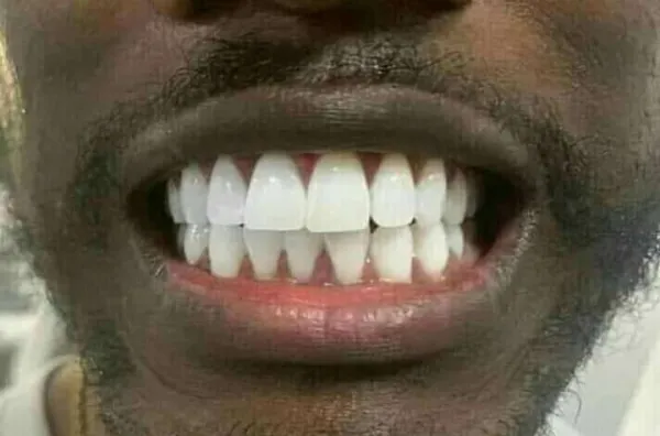 Royal Smile Braces & Dental Clinic, New Gra, Phc