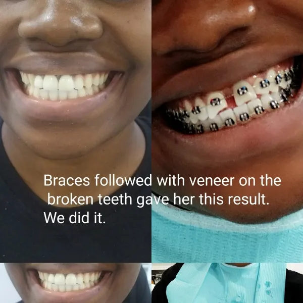 Smile Best Dental Clinic